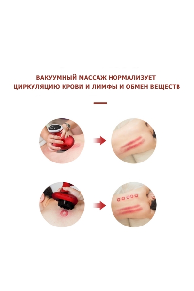 Массажер для тела антицеллюлитный KZ0558 электрический, с ИК прогревом, беспроводной Массажер для тела антицеллюлитный KZ0558 электрический, с ИК прогревом, беспроводной