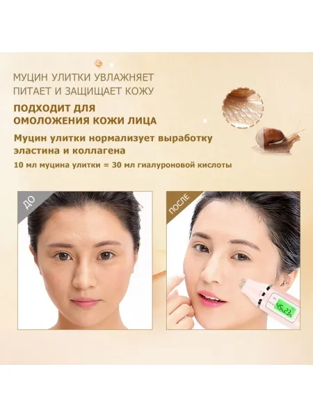 Набор косметический для ухода за кожей лица ONE SPRING SNAIL, с муцином улитки, увлажняющий, питающий, с омолаживающим эффектом, 6 шт. Набор косметический для ухода за кожей лица ONE SPRING SNAIL, с муцином улитки, увлажняющий, питающий, с омолаживающим эффектом, 6 шт.